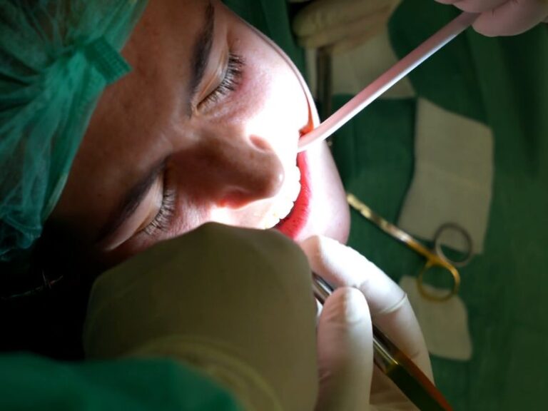 prikaz osobe kojoj hirurzi vade umnjak