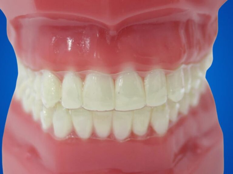 proteza za zube na plavoj pozadini